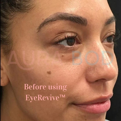 EyeRevive™ Eye Massager